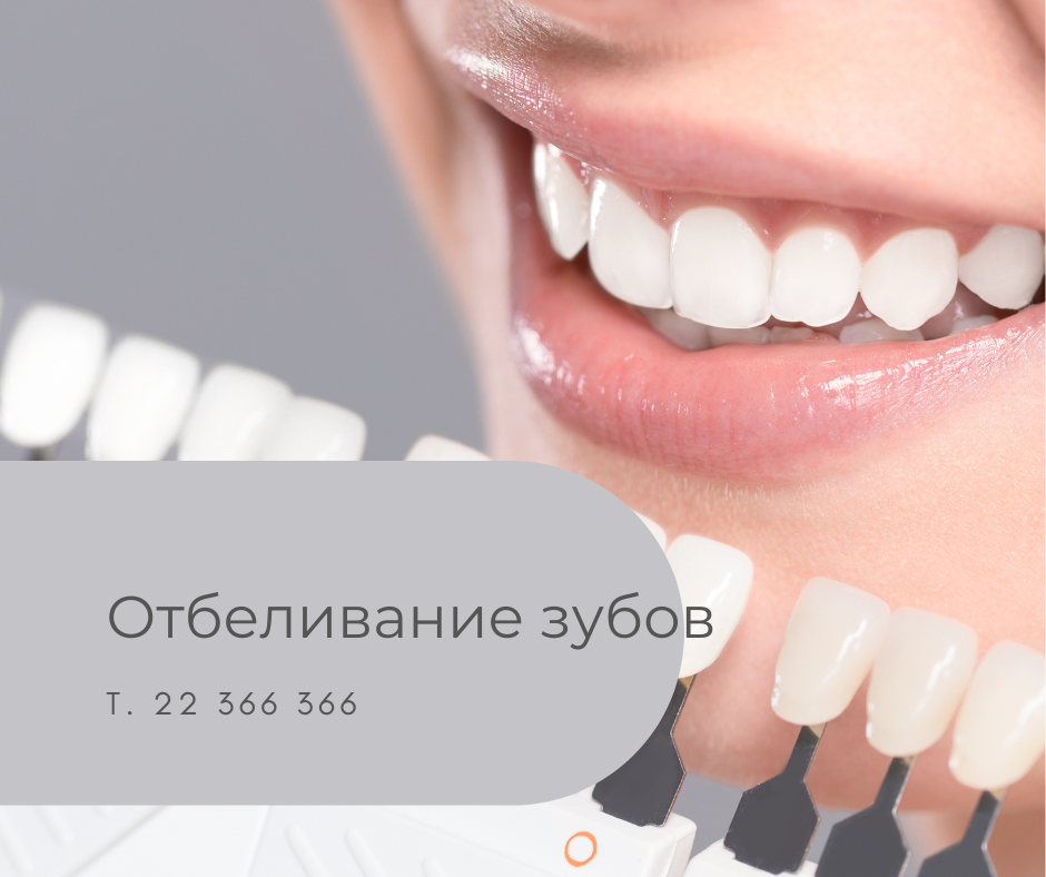 На фотографии изображено нанесение шкалы Вита на зубы для точного определения цветового тона. Этот процесс помогает выбрать оптимальную процедуру отбеливания для достижения желаемого результата.