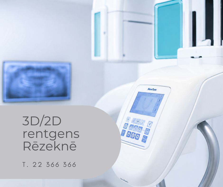 3D–2D panorāmas rentgens Rēzeknē Medicīnas centrā 36,6